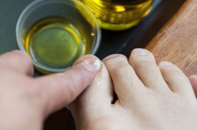 Fungus treatment