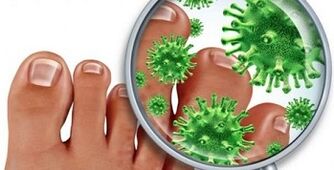 How to treat a fungal finger infection