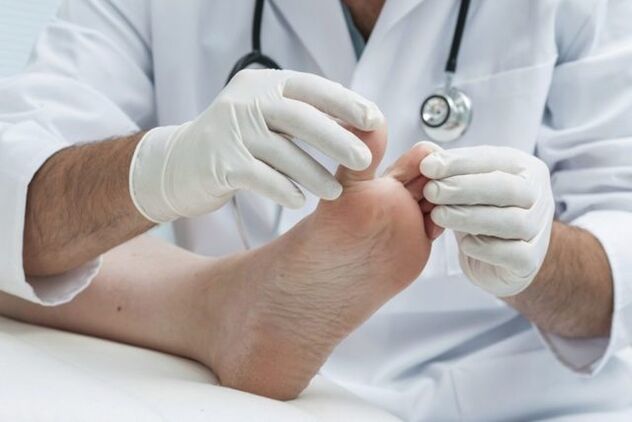 diagnosis of foot fungus by a doctor