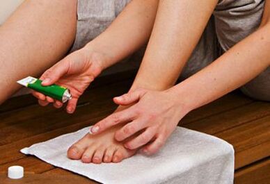 applying an ointment to treat toenail fungus